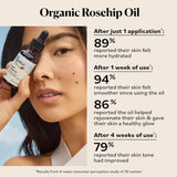 SKY ORGANICS ORGANIC ROSEHIP OIL 1OZ