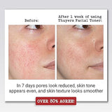 Thayers Witch Hazel Holiday Edition