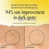 DERMA E VIT C RENEWING MOISTURIZER 2OZ